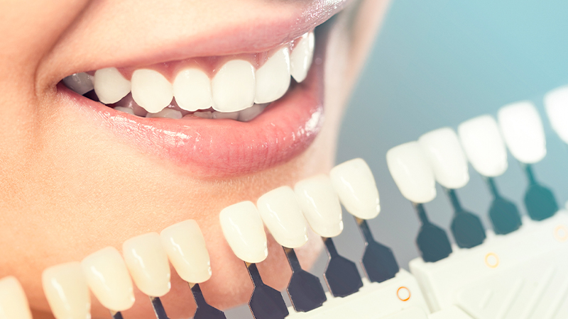 Cosmetic Dentistry