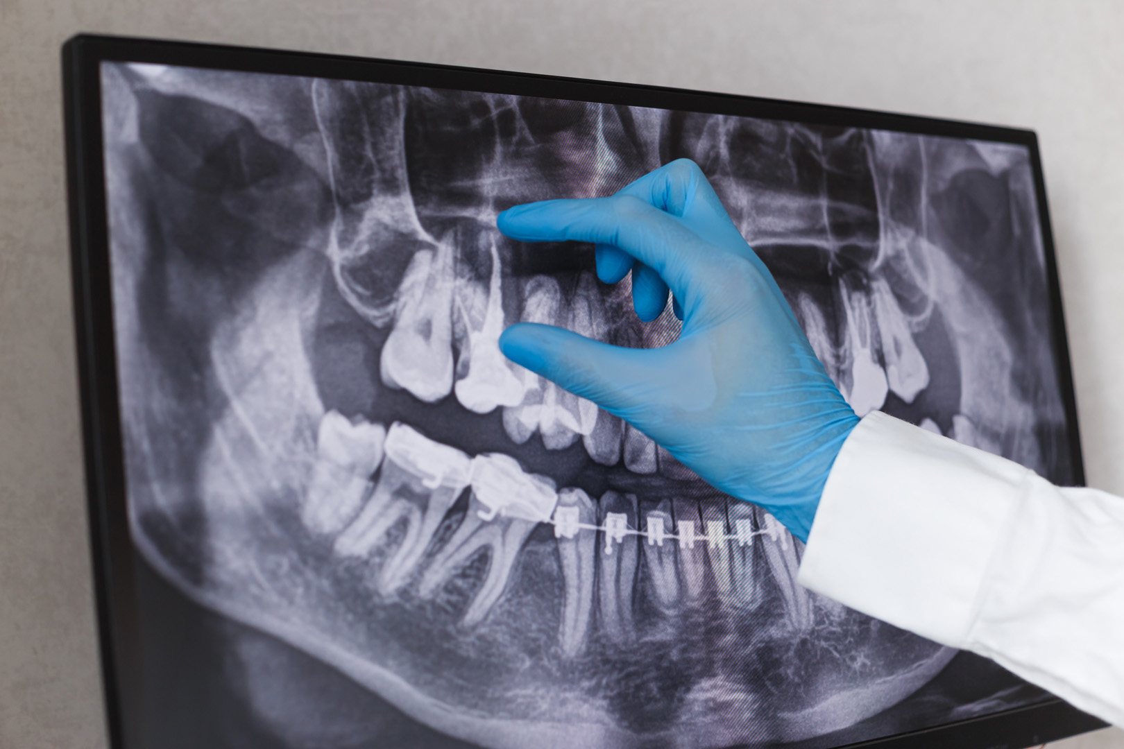 X-ray