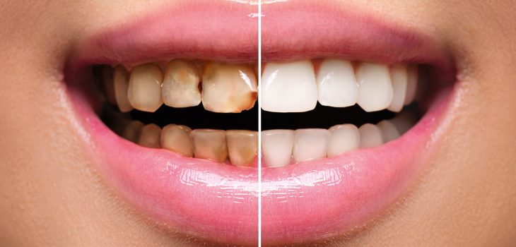 Restorative Dentistry