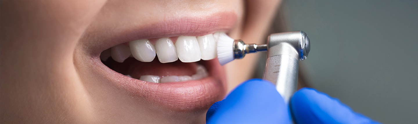 Teeth Cleaning