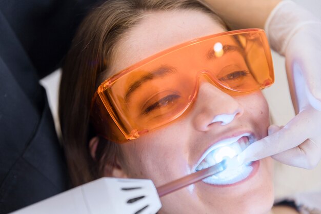 Whitening Process
